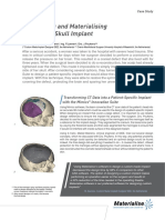 L-10011 Revision 3 02 2014 Designing and Materialising Custom Skull Implant IDEE