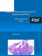  Atypical Fibroxanthoma (AFX), M 80, Scalp.