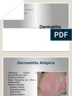 Dermatitis Atopica 
