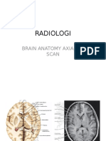 Brain anatomy axial CT scan