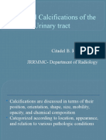 Calcifications of The Urinary Tract