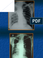 Foto Teaching DM Radiologi