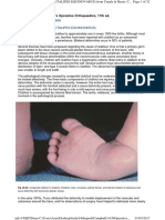 Congenital Clubfoot (Talipes Equinovarus) : Canale & Beaty: Campbell's Operative Orthopaedics, 11th Ed