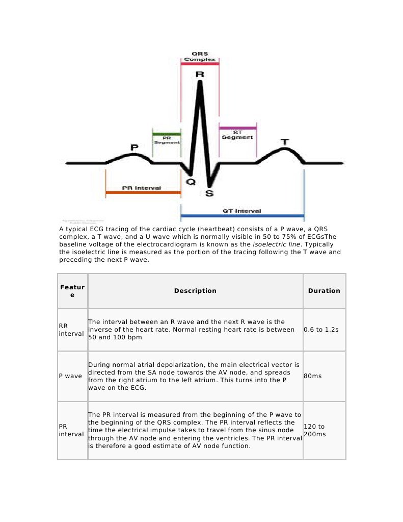 A Typical ECG Tracing of The Cardiac Cycle | PDF | Electrocardiography ...