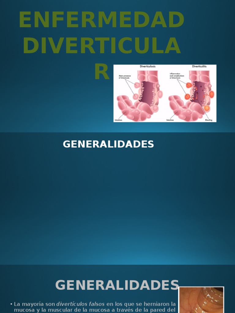 Diverticulitis | Descargar gratis PDF | Rtt | Enfermedades y trastornos