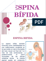 Espina Bifida