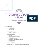 Skenario 1 Mata Merah