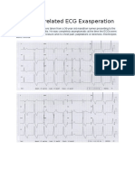 Marathon-Related ECG Exasperation