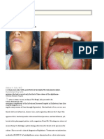 Respiratory Diphtheria: Images in Clinical Medicine