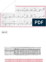 Pratica ECG 2