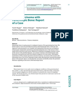 Rectal Carcinoma With Heterotopic Bone: Report of A Case