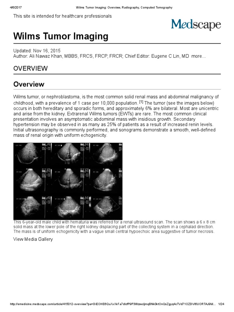 Wilms Tumor Imaging - Overview, Radiography, Computed Tomography | PDF ...