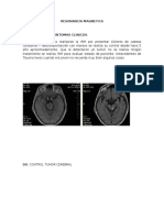 Irm Encefalo Contrastada