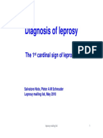 Diagnosing Leprosy with Loss of Sensation