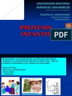 Prótesis Infantil