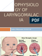 Patofisiologi Laringomalasia