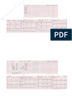 Electrocardiogram As