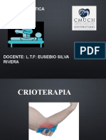 crioterapia.pptx