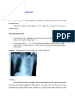 Asuhan Keperawatan Hemotorax