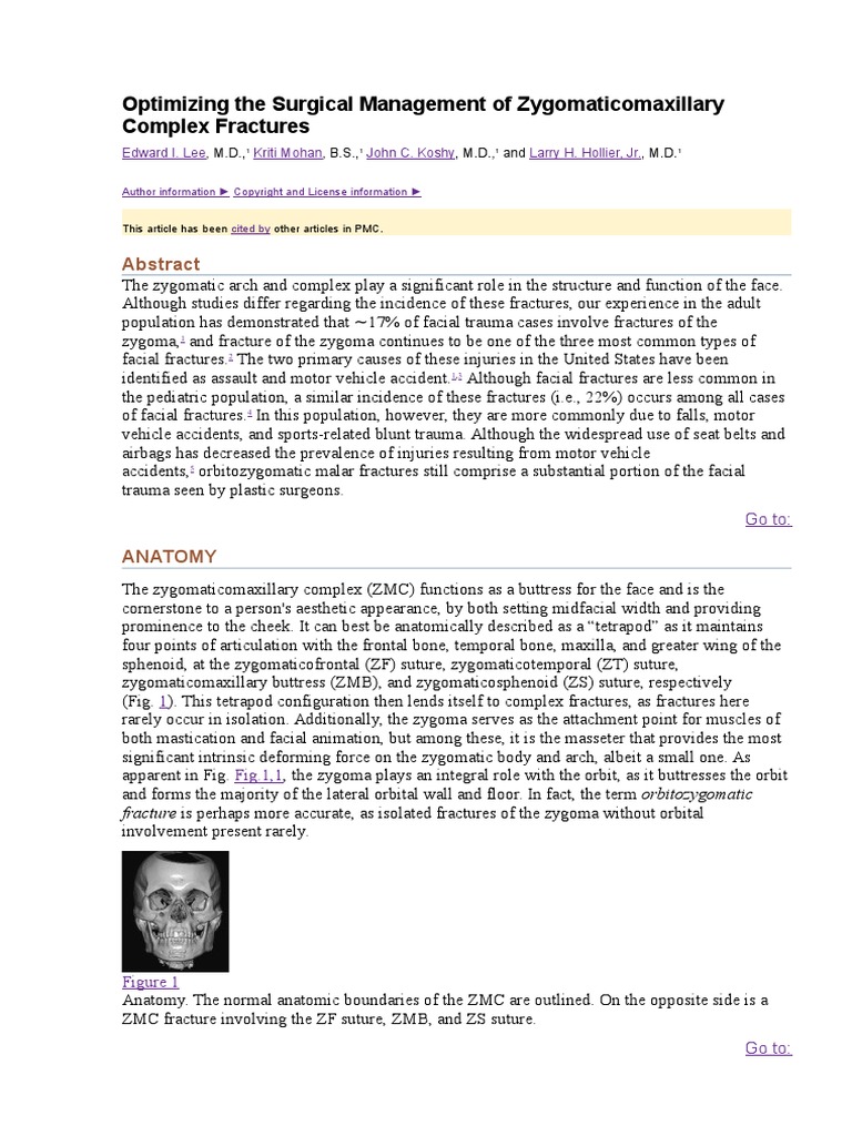 Optimizing The Surgical Management Of Zygomaticomaxillary Complex