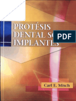 Misch Protesis Dental Sobre Implantes