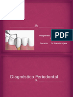 Diagnostico Periodontal