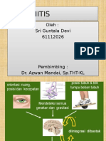 Labirinitis Lala