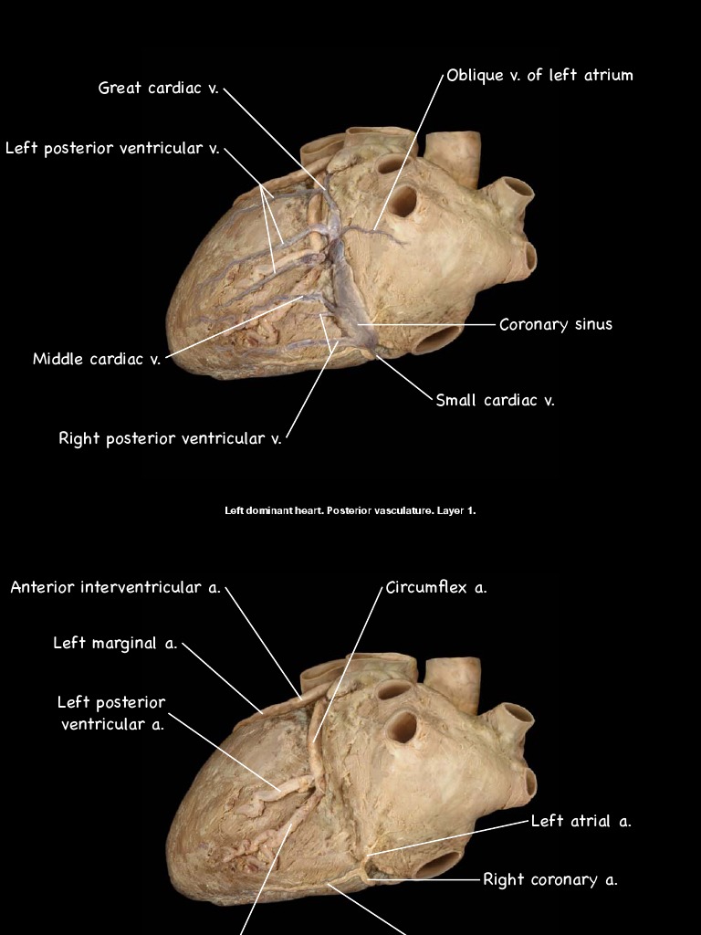 Vasculatura del corazón dominante izquierdo | PDF