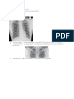 X Ray Thorax