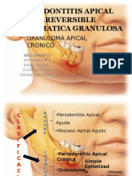 Endodonciaperiodontitis Apical Irreversible Asintomatica Granulosa