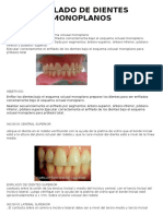 Enfilado de Dientes Monoplanos