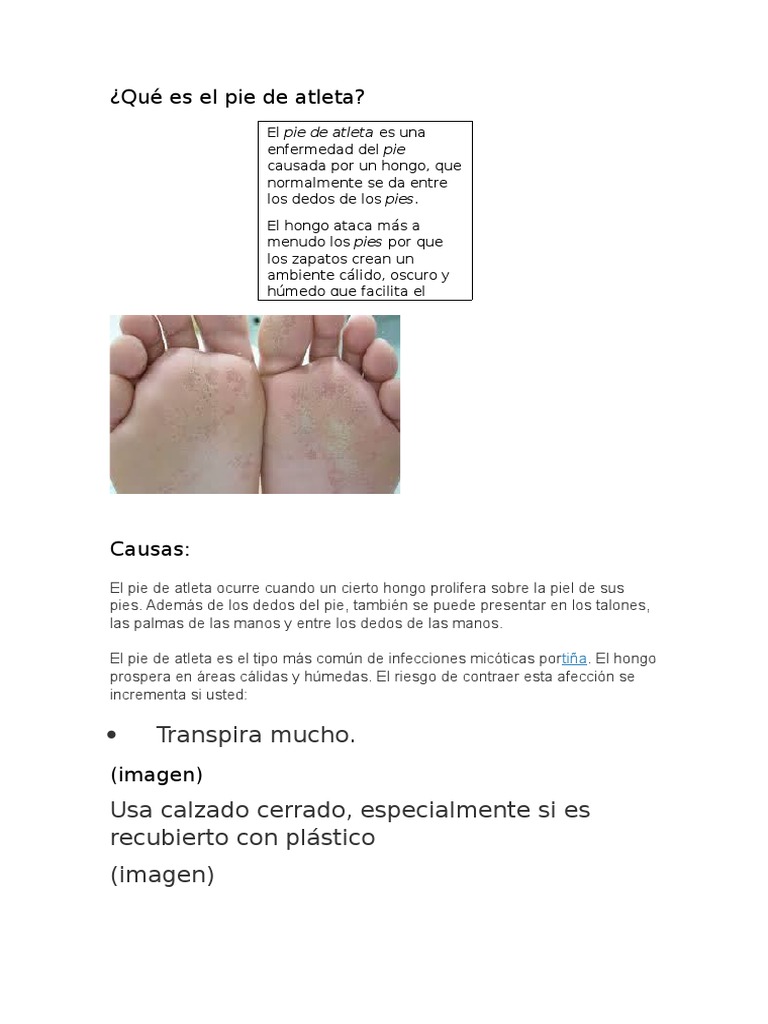 Qué Es El Pie de Atleta PDF Infección Microbiología