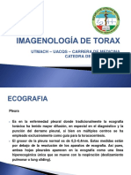 Imagenología de Torax