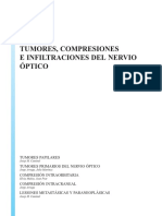 Tumores Compresiones e Infiltraciones Del Nervio Optico[3074]