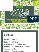 Kasus Dermatitis Numularis