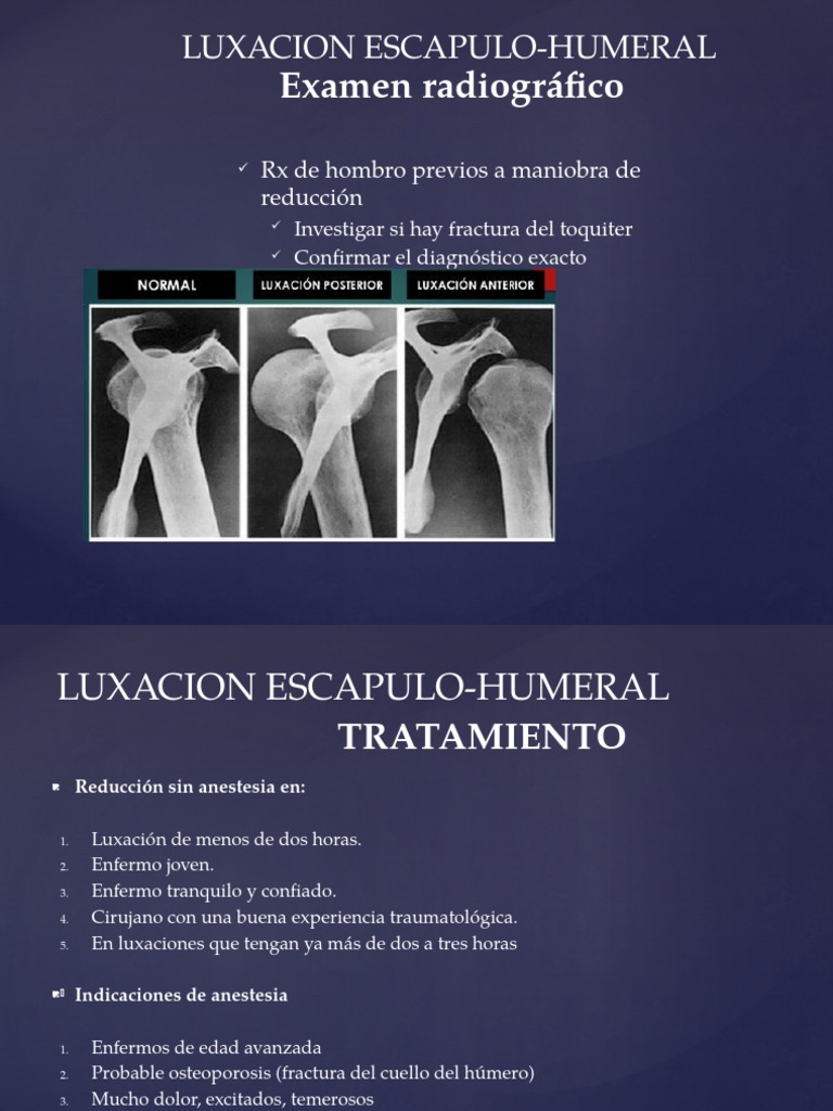 Luxacion Escapulo Humeral