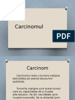 186495624-Carcinom.pptx