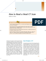How to Read a Head CT Scan.pdf