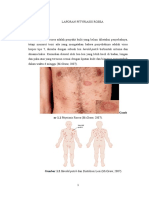 Laporan Pityriasis Rosea