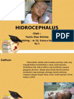 HIDROCEPHALUS