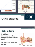 Otits Externa