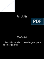 Parotitis