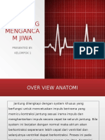 Aritmia Yg Mengancam Jiwa