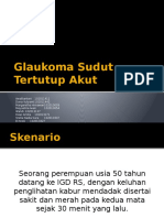 Glaukoma Sudut Tertutup Akut