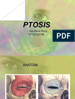 Ptosis With Background
