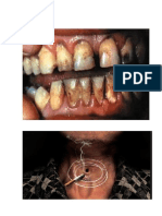 Enfermedades causadas por el Tabaco.docx