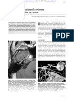 Bell's Palsy With Ipsilateral Numbness: Short Report