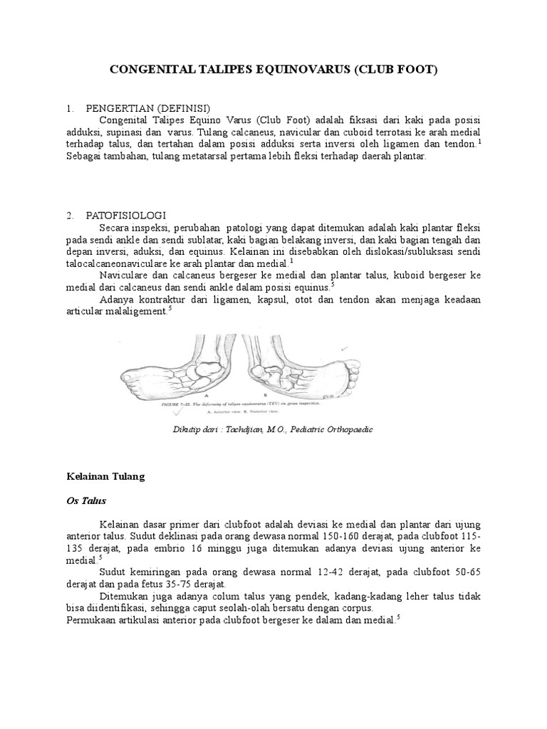 Congenital Talipes Equinovarus PDF