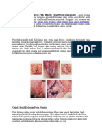 Inilah Gejala Kutil Kelamin Pada Wanita Yang Harus Diwaspadai