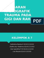 (A-07) Gambaran Radiografik Trauma Gigi Dan Rahang